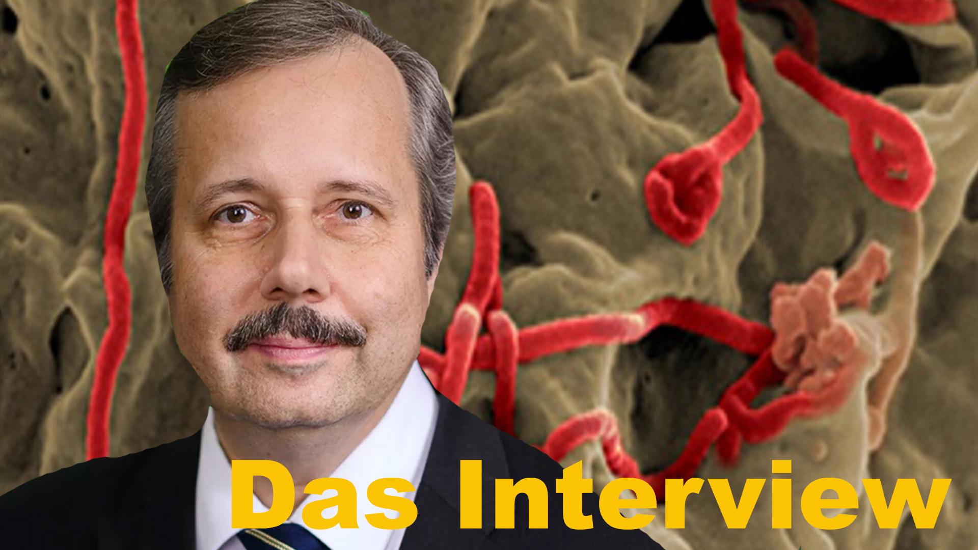 Prof. Wiesendanger Hat ein USLaborunfall 2014 die EbolaEpidemie